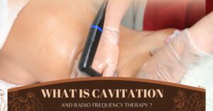 What is cavitation and radio frequency therapy