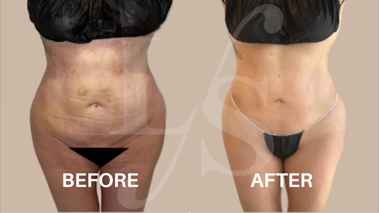 Surgical recovery post-op result 1