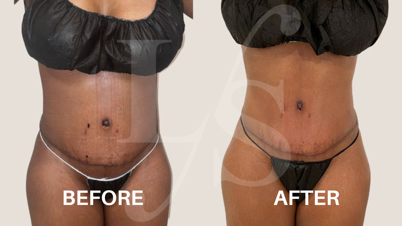 Surgical recovery post-op result 10