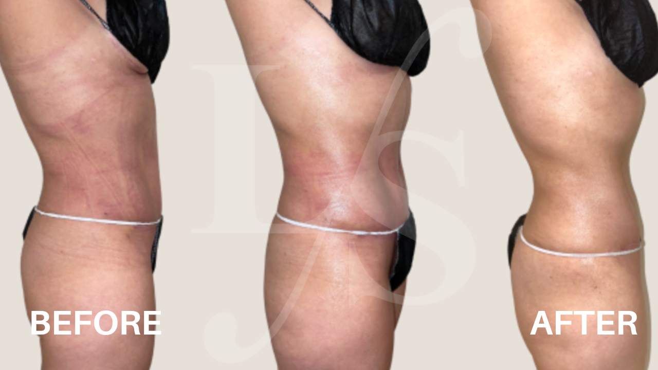 Surgical recovery post-op result 2
