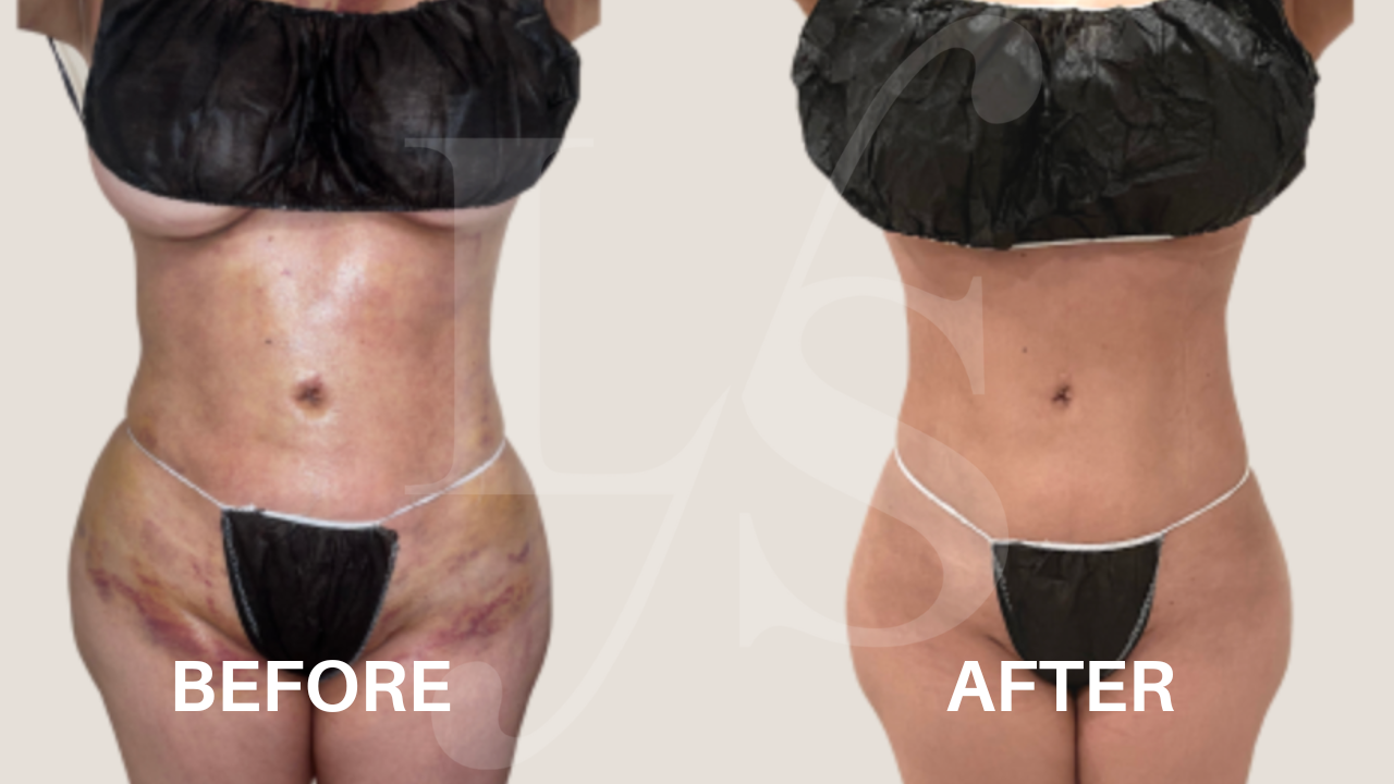 Surgical recovery post-op result 3