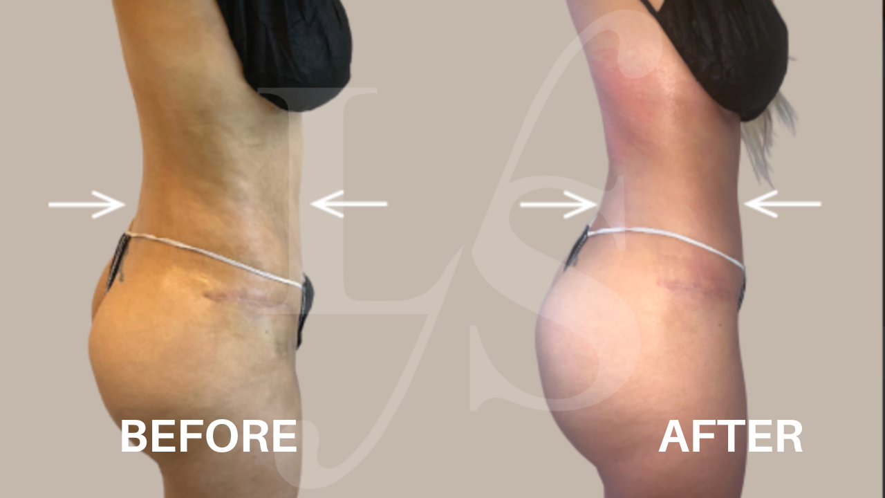 Surgical recovery post-op result 4