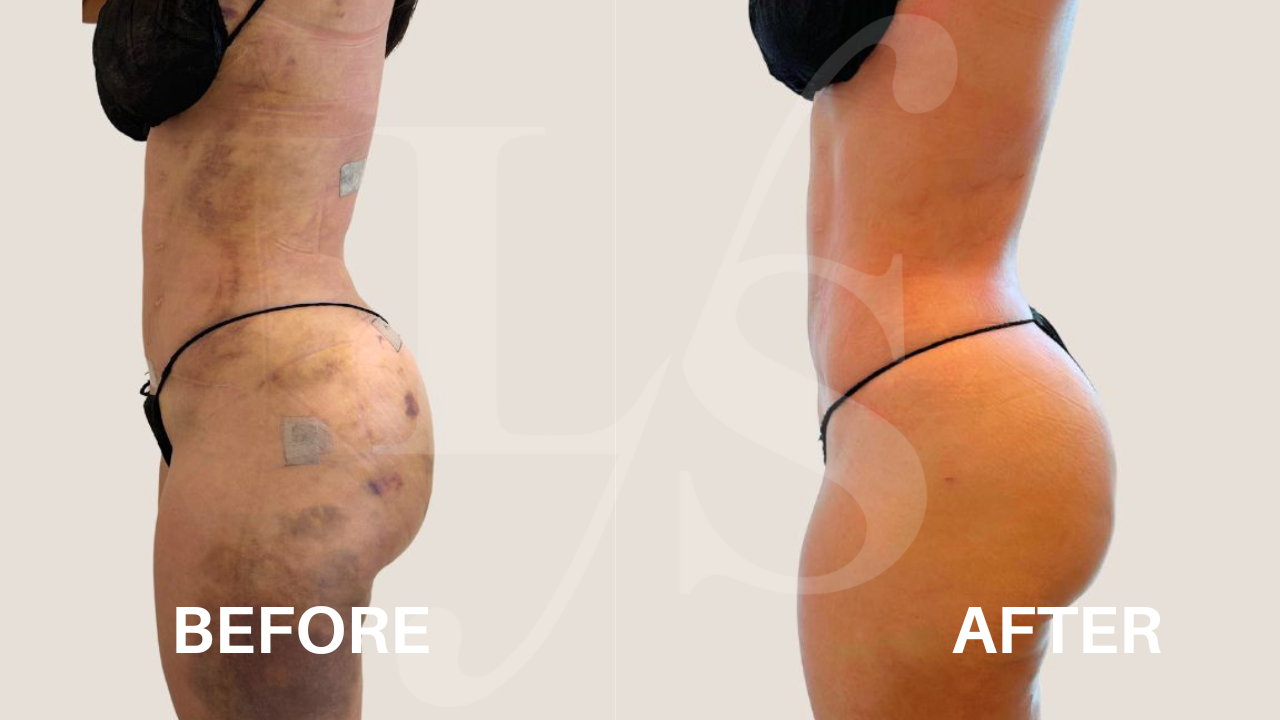 Surgical recovery post-op result 5