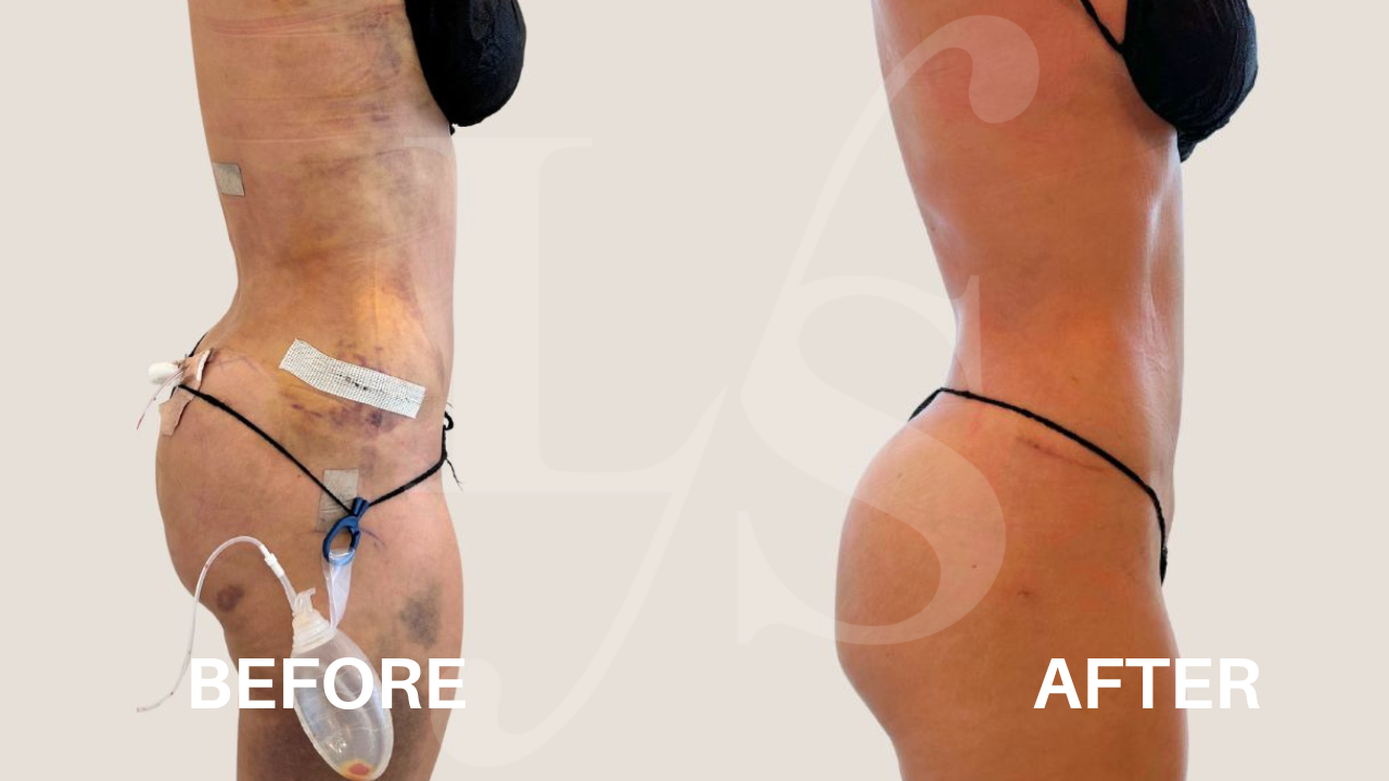 Surgical recovery post-op result 6