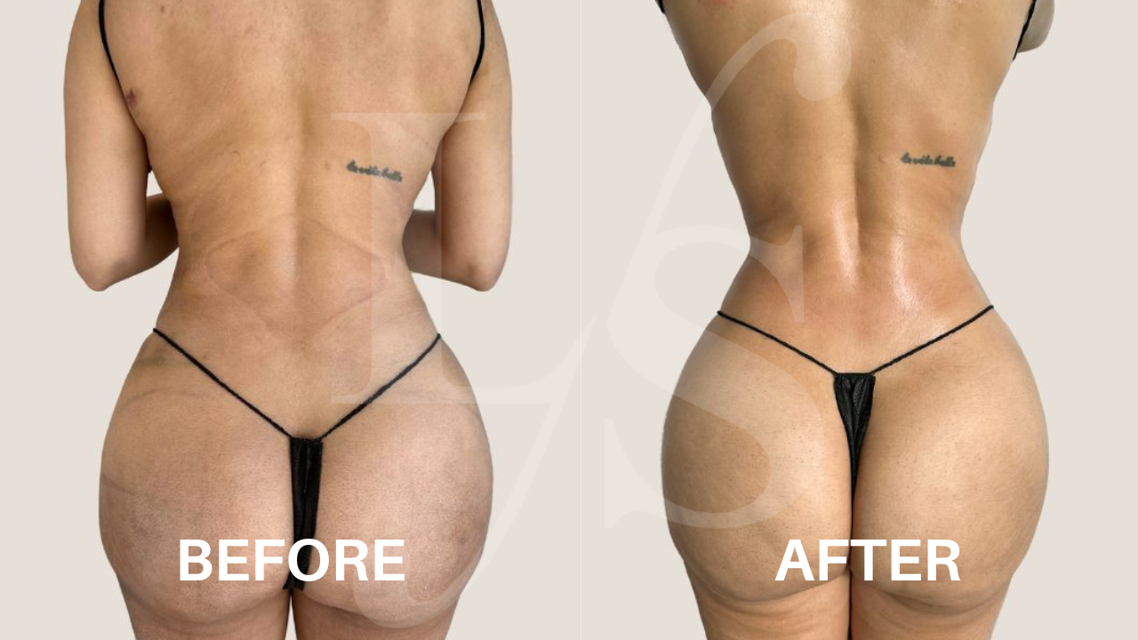 Surgical recovery post-op result 7