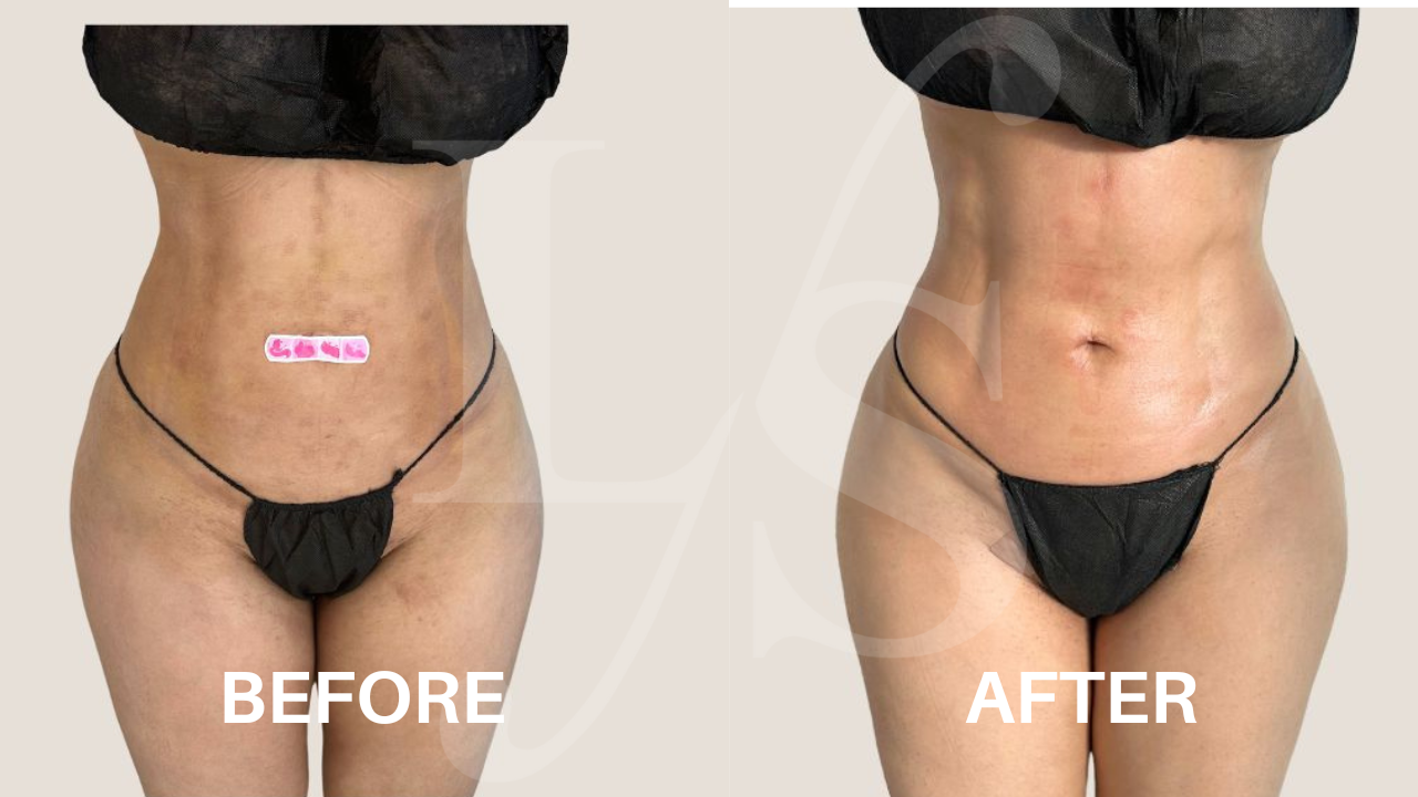 Surgical recovery post-op result 8