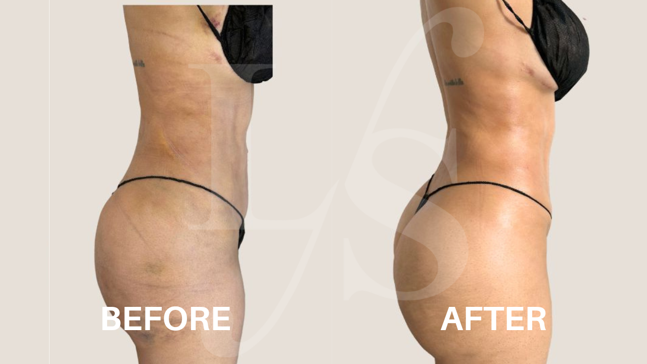 Surgical recovery post-op result 9